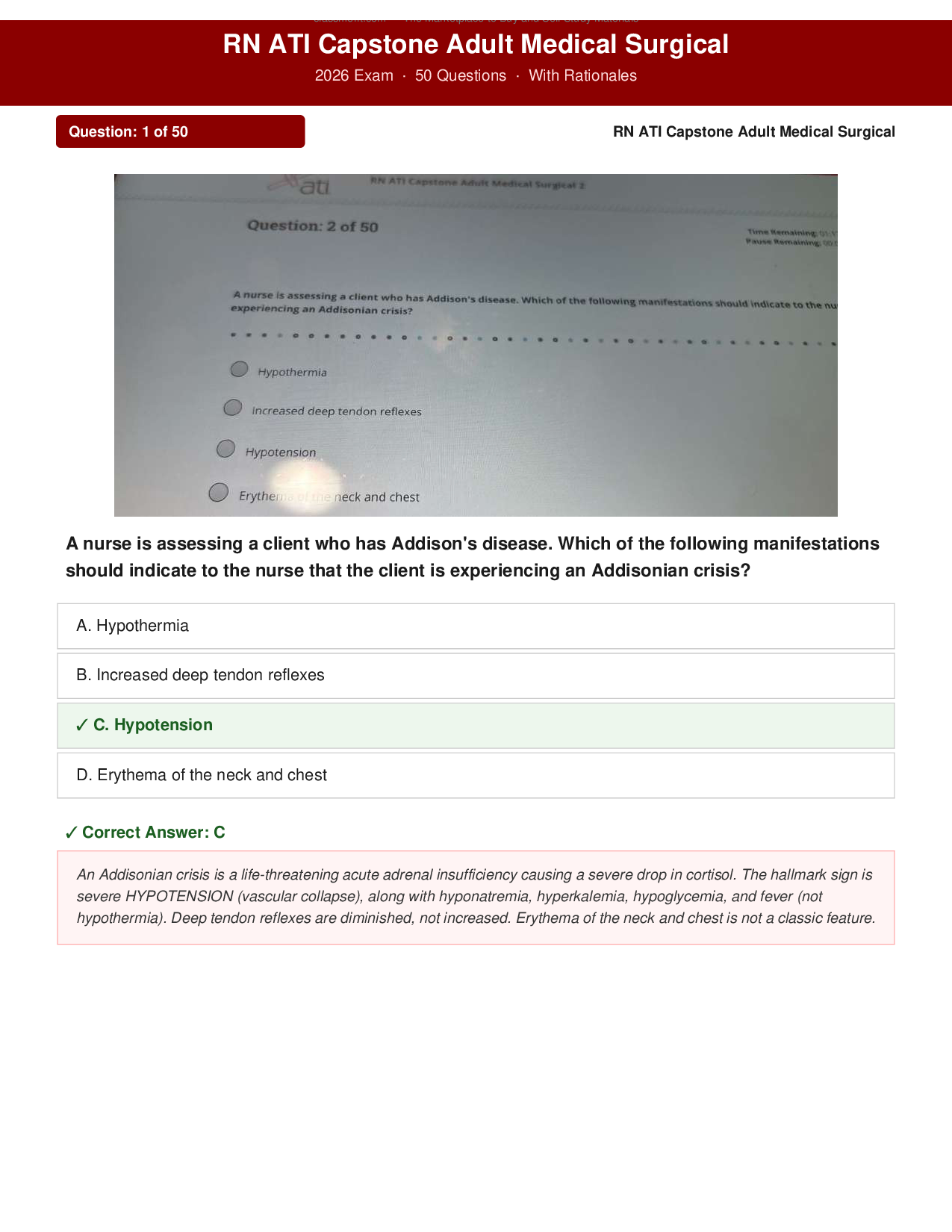 RN ATI Capstone Adult Medical Surgical 2026 Exam Practice Questions