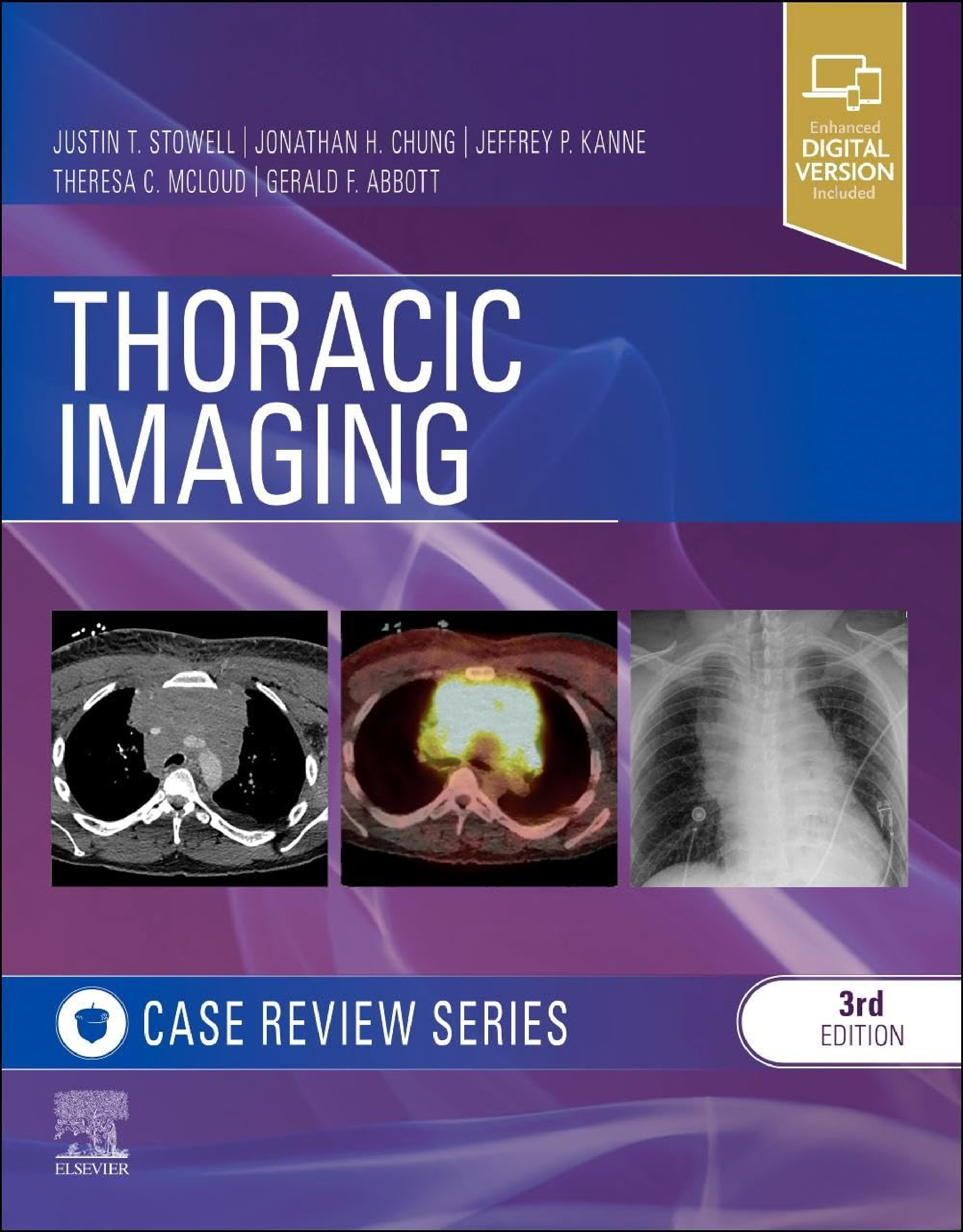 Thoracic Imaging: Case Review Series, 3rd Edition