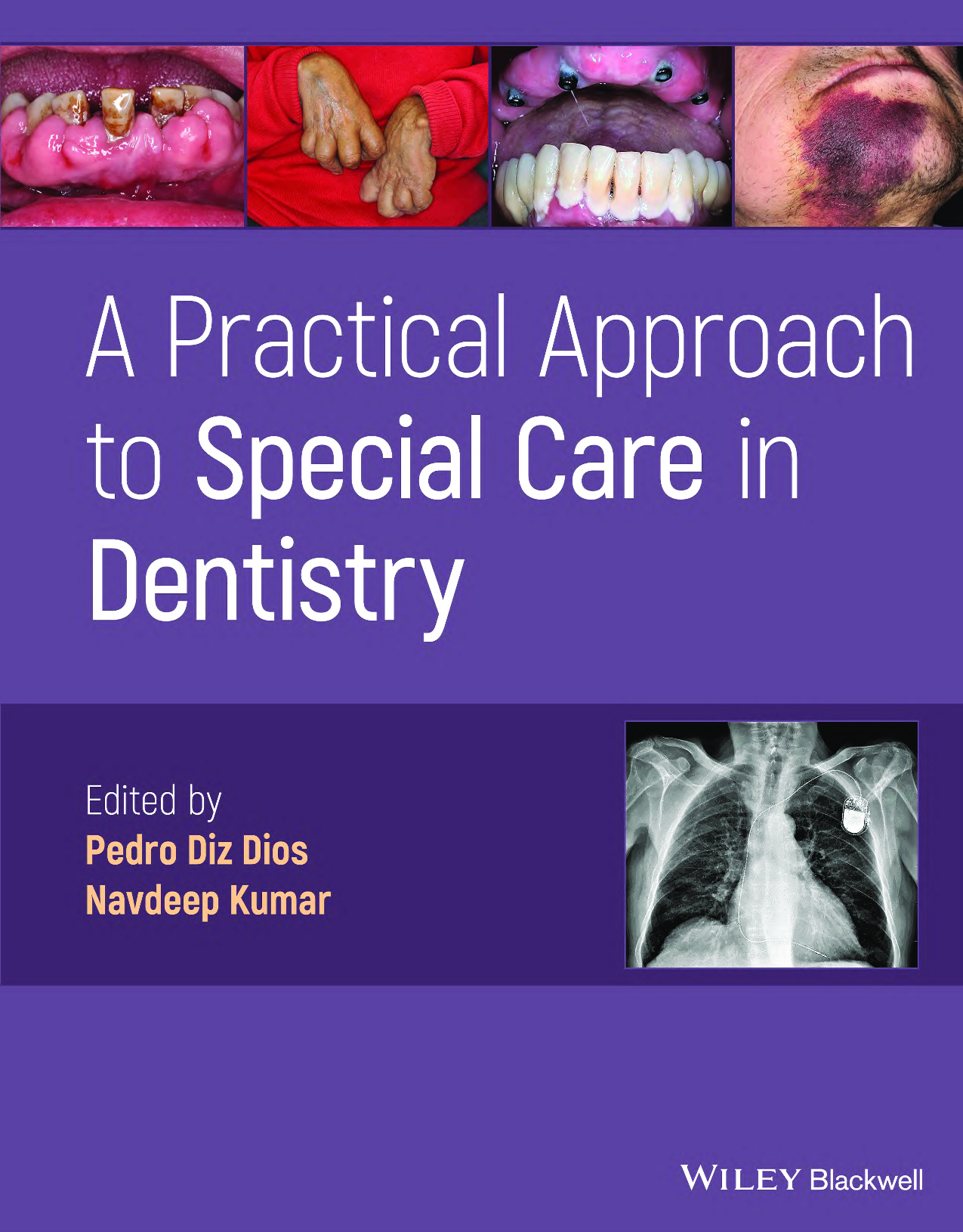 A Practical Approach to Special Care in Dentistry, 1st Edition Ebook